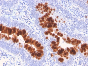 Fas Antibody Human Colon Tissue IHC. Immunohistochemistry analysis of FFPE human colon tissue using FAS Antibody (clone FAS/3112) shows strong HRP-DAB brown cytoplasmic and membranous staining in glandular epithelial cells, consistent with CD95 / FAS apoptosis receptor expression and its role in epithelial cell turnover and programmed cell death signaling, while surrounding stromal cells display minimal signal; nuclei are counterstained blue. HIER: boil tissue sections in pH 9 10 mM Tris with 1 mM EDTA for 20 min and allow to cool before testing.