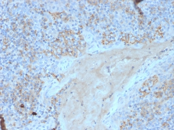 CD95 Antibody Human Tonsil Tissue IHC. Immunohistochemistry analysis of FFPE human tonsil tissue using CD95 Antibody (clone FAS/3588) demonstrates HRP-DAB brown membranous and cytoplasmic staining in lymphoid cells within germinal center and interfollicular regions, consistent with CD95 / FAS as an immune apoptosis marker regulating lymphocyte activation and programmed cell death, while surrounding stromal elements show minimal background; nuclei are counterstained blue. HIER: boil tissue sections in pH 9 10 mM Tris with 1 mM EDTA for 20 min and allow to cool before testing.