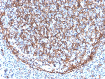 IHC staining of FFPE human tonsil with CD11b antibody (clone ITGAM/3340). HIER: boil tissue sections in pH 9 10mM Tris with 1mM EDTA for 20 min and allow to cool before testing.