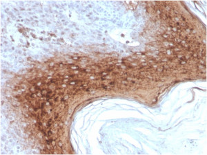IVRN Antibody rIVRN/827 in Human Tonsil IHC. Immunohistochemistry testing of FFPE human tonsil tissue with IVRN Antibody clone rIVRN/827. Strong brown cytoplasmic staining is concentrated in the differentiated suprabasal squamous epithelium, while the more basal epithelial region shows substantially weaker staining. The image shows the characteristic differentiation-associated distribution of involucrin within stratified squamous epithelium and demonstrates tissue detection using this Involucrin Monoclonal Antibody.