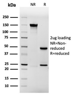 Purified IVRN Antibody rIVRN/827 SDS-PAGE. SDS-PAGE analysis of purified, BSA-free IVRN Antibody clone rIVRN/827 under non-reducing (NR) and reducing (R) conditions with a 2 ug antibody load. The non-reduced preparation shows a predominant intact antibody band at approximately 150 kDa. Under reducing conditions, the antibody resolves into approximately 50 kDa heavy-chain and 25 kDa light-chain bands. The expected electrophoretic profile demonstrates the integrity of the purified recombinant mouse Involucrin Monoclonal Antibody preparation.
