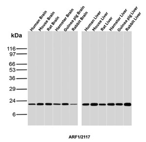 ADP-Ribosylation Factor 1 Antibody ARF1/2117 Across Six Mammalian Species WB. Western blot analysis of brain and liver tissue lysates with ADP-Ribosylation Factor 1 Antibody clone ARF1/2117. Brain lanes: human, mouse, rat, hamster, guinea pig and rabbit. Liver lanes: human, mouse, rat, hamster, guinea pig and rabbit. A strong, discrete band is detected at approximately 20-21 kDa across all twelve samples, consistent with the expected molecular weight of ARF1. The remarkably uniform target-sized signal and minimal additional reactivity demonstrate broad cross-species recognition and strong western blot performance of the ARF1 Monoclonal Antibody.