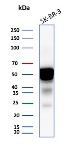 Western blot testing of human SK-BR-3 cell lysate with Cytokeratin 7 Antibody KRT7/2200. Predicted molecular weight ~51 kDa.
