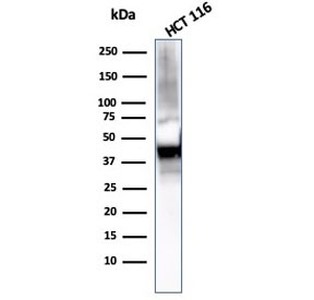 Cytokeratin 8 Antibody HCT116 WB. Western blot analysis of human HCT116 cell lysate using Cytokeratin 8 Antibody / Protein Microarray Validated Antibody (clone KRT8/2115) demonstrates a prominent immunoreactive band at approximately 56 kDa. The observed molecular weight is consistent with the predicted size of Keratin 8 (KRT8), a type II intermediate filament protein that serves as a major structural component of simple epithelial cells. Detection of the expected target in HCT116 colorectal carcinoma cells is consistent with the established expression of KRT8 in epithelial-derived tissues and malignancies. The observed immunoreactivity demonstrates the utility of this antibody for studies of epithelial differentiation, intermediate filament organization, cytoskeletal biology, tumor cell characterization, and epithelial-derived cancer research. Observed molecular weight: ~56 kDa. Expected molecular weight: ~56 kDa.