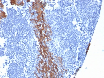 IHC staining of FFPE human tonsil with Cytokeratin 13 antibody (clone KRT13/2659). HIER: boil tissue sections in pH 9 10mM Tris with 1mM EDTA for 20 min and allow to cool before testing.
