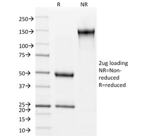 SDS-PAGE analysis of purified, BSA-free Cytokeratin 15 antibody (clone KRT15/2957) as confirmation of integrity and purity.