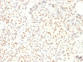 IHC staining of FFPE human pancreas with LMO2 antibody. HIER: boil tissue sections in pH 9 10mM Tris with 1mM EDTA for 10-20 min and allow to cool before testing.