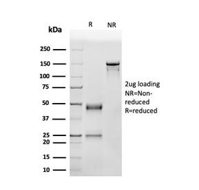 SDS-PAGE analysis of purified, BSA-free p53 Antibody Clone SPM514 / TP53 Tumor Suppressor Antibody as confirmation of integrity and purity.