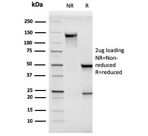SDS-PAGE analysis of purified, BSA-free MCAM antibody (clone MCAM/3046) as confirmation of integrity and purity.