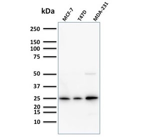 Mammaglobin Antibody for WB - western blot analysis. Western blot testing of human cell lysates using Mammaglobin Antibody for WB (clone SPM518). Lane 1: MCF7 cell lysate, Lane 2: T47D cell lysate, Lane 3: MDA-231 cell lysate. A band is detected at approximately 10-21 kDa, consistent with the predicted molecular weight of Mammaglobin / SCGB2A2. Differences in apparent molecular weight may reflect glycosylation and other post-translational modifications that influence migration of this secreted breast-associated protein during SDS-PAGE.