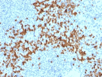 Immunohistochemistry analysis of MMP9 / Matrix metalloproteinase 9 antibody (clone 2C3) in human spleen tissue. FFPE human spleen section shows prominent cytoplasmic brown chromogenic staining in scattered immune cells within the splenic parenchyma, consistent with MMP9 expression, while surrounding lymphoid cells display minimal staining and nuclei appear blue. Heat-induced epitope retrieval was performed by boiling tissue sections in pH 9 10 mM Tris with 1 mM EDTA for 20 minutes followed by cooling prior to staining.
