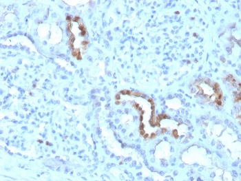 IHC staining of FFPE human kidney with CALB1 antibody (clone CALB1/3333). HIER: boil tissue sections in pH 9 10mM Tris with 1mM EDTA for 20 min and allow to cool before testing.
