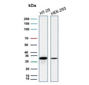 Western blot testing of human HT-29 and HEK293 cell lysate with recombinant MTAP antibody. Expected molecular weight: 26-38 kDa (multiple isoforms).