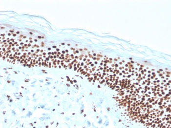 IHC staining of FFPE human skin with recombinant Nucleophosmin antibody (clone rNPM1/1901). HIER: boil tissue sections in pH 9 10mM Tris with 1mM EDTA for 20 min and allow to cool before testing.