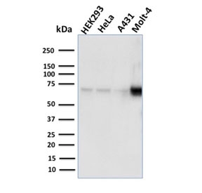 Western blot testing of human samples with NRF1 antibody (clone NRF1/2609). Expected molecular weight: isoforms from 45-67 kDa.