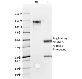 SDS-PAGE analysis of purified, BSA-free ROR2 antibody (clone ROR2/1912) as confirmation of integrity and purity.