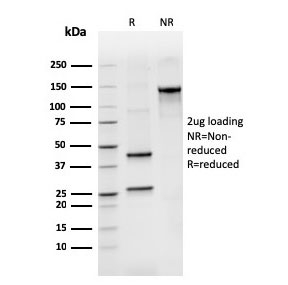 SDS-PAGE analysis of purified, BSA-free recombinant IgM antibody (clone rIGHM/3802) as confirmation of integrity and purity.