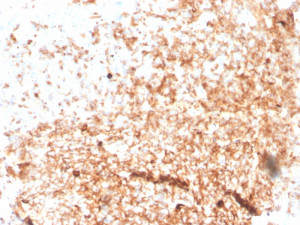 Recombinant IgM Antibody rIGHM/3802 Immunohistochemistry. IHC staining of FFPE human tonsil with recombinant IgM antibody (clone rIGHM/3802). HIER: boil tissue sections in pH 9 10mM Tris with 1mM EDTA for 10-20 min and allow to cool before testing.