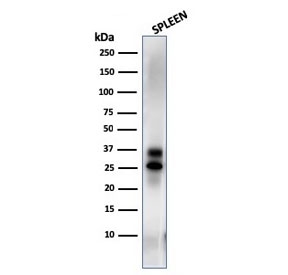 Granzyme B Antibody Human Spleen WB. Western blot analysis of human spleen lysate using Granzyme B Antibody. An HRP-conjugated secondary antibody with ECL substrate was used for detection. Granzyme B Antibody, a Cytotoxic Lymphocyte Marker Antibody, detects bands at approximately 29-37 kDa, consistent with the expected molecular weight range of granzyme B. The higher molecular weight band likely represents the precursor form, while the lower band is consistent with proteolytic processing to the mature active enzyme.