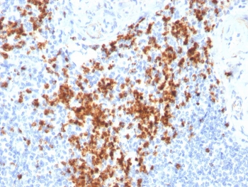 Granzyme B Antibody Human Spleen IHC. Immunohistochemical staining of FFPE human spleen tissue using Granzyme B Antibody. HIER was performed in pH 9 Tris-EDTA buffer. An HRP-conjugated secondary antibody with DAB substrate was used for detection. Granzyme B Antibody, a Cytotoxic Lymphocyte Marker Antibody, demonstrates strong granular cytoplasmic staining in numerous lymphocytes within the splenic white pulp, consistent with granzyme B expression in activated cytotoxic T lymphocytes and natural killer cells.