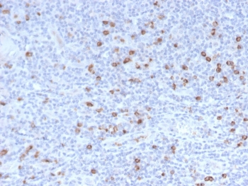 Granzyme B Antibody Human Tonsil IHC. Immunohistochemical staining of FFPE human tonsil tissue using Granzyme B Antibody. HIER was performed in pH 9 Tris-EDTA buffer. An HRP-conjugated secondary antibody with DAB substrate was used for detection. Granzyme B Antibody, a Cytotoxic Lymphocyte Marker Antibody, demonstrates strong granular cytoplasmic staining in scattered lymphocytes within the tonsillar lymphoid tissue, consistent with granzyme B expression in activated cytotoxic T lymphocytes and natural killer cells.