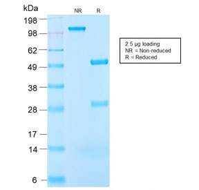 SDS-PAGE analysis of purified, BSA-free recombinant Insulin-like Growth Factor 1 antibody (clone IGF1/2872R) as confirmation of integrity and purity.