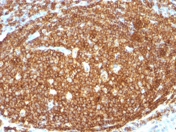 IHC staining of FFPE human tonsil with CD45RB antibody. HIER: steam section in pH 9 10mM Tris with 1mM EDTA for 20 min and allow to cool prior to staining.