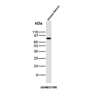 Recombinant IgM Antibody IGHM/3776R in Human Serum WB. Western blot testing of human serum with Recombinant IgM Antibody clone IGHM/3776R detects a discrete band at approximately 75 kDa, consistent with the expected size of the immunoglobulin mu heavy chain. Minimal additional reactivity is visible under the tested conditions, producing a clean Western blot signal. This recombinant rabbit monoclonal recognizes the heavy chain component of human IgM.