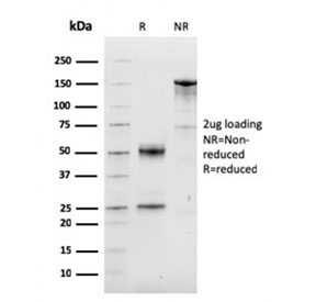 SDS-PAGE analysis of purified, BSA-free Cyclin D1 antibody (clone CCND1/3548) as confirmation of integrity and purity.