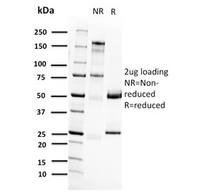 SDS-PAGE analysis of purified, BSA-free RET antibody (clone RET/2662) as confirmation of integrity and purity.
