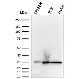 Western blot testing of human spleen, PC3 and liver lysate with C1QA antibody (clone C1QA/2783). Predicted molecular weight ~26 kDa.