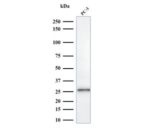 Western blot testing of human PC3 cell lysate with C1QA antibody. Predicted molecular weight ~26 kDa.
