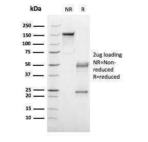 SDS-PAGE analysis of purified, BSA-free C1QA antibody as confirmation of integrity and purity.