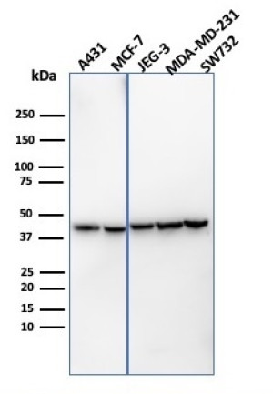 Recombinant PD-L1 Antibody PDL1/4451R in Human Cancer Cell Lines WB. Western blot testing of Recombinant PD-L1 Antibody PDL1/4451R / B7-H1 in human A431, MCF-7, JEG-3, MDA-MB-231 and SW732 cell lysates. A prominent band is observed at approximately 40-45 kDa across the tested cell lines, above the predicted molecular weight of ~33 kDa for unmodified PD-L1/CD274. The higher apparent molecular weight is consistent with the established N-linked glycosylation of mature PD-L1. This Recombinant PD-L1 Antibody demonstrates detection of glycosylated B7-H1/CD274 across multiple human cancer cell lines.