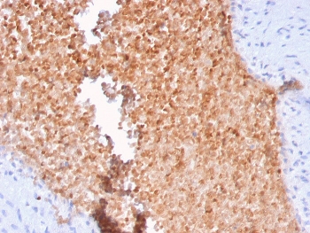 Alpha II Spectrin antibody IHC staining of FFPE human lung tissue using clone SPTAN1/3352. HIER: boil tissue sections in pH6, 10mM citrate buffer, for 20 min and allow to cool before testing.