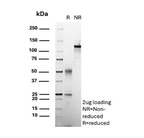 SDS-PAGE analysis of purified, BSA-free BRCA1 antibody (clone BRCA1/2986) as confirmation of integrity and purity.