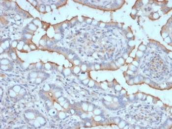 STARD1 Antibody (clone STAR/2077). Immunohistochemistry analysis of Steroidogenic Acute Regulatory Protein (StAR / STARD1) in FFPE human stomach tissue using a mouse monoclonal antibody. HRP-DAB brown cytoplasmic staining is observed in scattered epithelial and glandular cells, while most surrounding gastric mucosal cells show minimal staining. The staining pattern is consistent with localized expression of Steroidogenic Acute Regulatory Protein in specific gastric cell populations. Heat-induced epitope retrieval was performed by boiling tissue sections in pH 9 Tris-EDTA buffer (10 mM Tris with 1 mM EDTA) for 20 minutes followed by cooling prior to antibody staining.