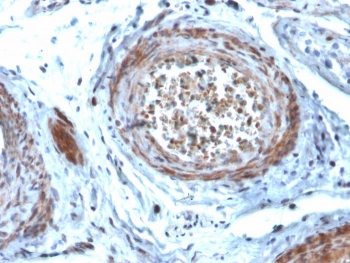 STARD1 Antibody (clone STAR/2077). Immunohistochemistry analysis of Steroidogenic Acute Regulatory Protein (StAR / STARD1) in FFPE human testis tissue using a mouse monoclonal antibody. HRP-DAB brown cytoplasmic staining highlights steroidogenic Leydig cells within the interstitial compartment of the testis, consistent with the mitochondrial localization of StAR in testosterone-producing endocrine cells, while seminiferous tubules and surrounding non-steroidogenic cells show minimal staining. Heat-induced epitope retrieval was performed by boiling tissue sections in pH 9 Tris-EDTA buffer (10 mM Tris with 1 mM EDTA) for 20 minutes followed by cooling prior to antibody staining.