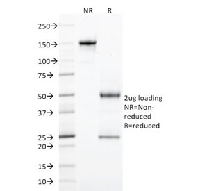 SDS-PAGE analysis of purified, BSA-free StAR/STARD1 antibody (clone STAR/2077) as confirmation of integrity and purity.