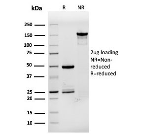 SDS-PAGE analysis of purified, BSA-free pS2 Antibody Recombinant Mouse MAb rTFF1/1091 as confirmation of integrity and purity.