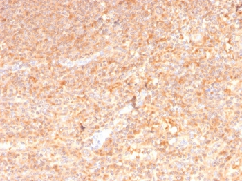 GM-CSF Antibody Human Spleen Immunohistochemistry. IHC staining of FFPE human spleen with GM-CSF antibody (clone CSF2/3402). HIER: boil tissue sections in pH 9 10mM Tris with 1mM EDTA for 10-20 min and allow to cool before testing.