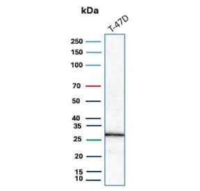 Western blot testing of human T-47D cell lysate with C1QA antibody. Predicted molecular weight ~26 kDa.