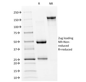 SDS-PAGE analysis of purified, BSA-free p53 Antibody Clone PAb240 / TP53 Mutant Tumor Suppressor Antibody as confirmation of integrity and purity.