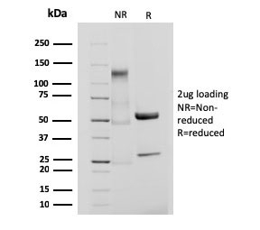 SDS-PAGE analysis of purified, BSA-free recombinant CD61 antibody (clone ITGB3/3126R) as confirmation of integrity and purity.
