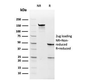 SDS-PAGE analysis of purified, BSA-free recombinant Thymidylate Synthase antibody (clone rTYMS/1884) as confirmation of integrity and purity.