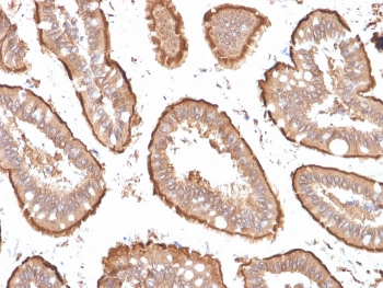 Villin Antibody. Immunohistochemistry analysis of Villin-1 (VIL1) in FFPE human small intestine using Villin Antibody / Intestinal Differentiation Marker Antibody with mouse monoclonal clones VIL1/1314 and VIL1/2376. Strong HRP-DAB brown staining is observed in mature enterocytes lining the villi, with prominent apical and luminal membrane accentuation consistent with a differentiated epithelial phenotype. The uniform staining pattern highlights fully developed intestinal epithelial architecture and supports Villin as a robust marker of enterocyte differentiation and epithelial maturation in normal small intestine tissue.
