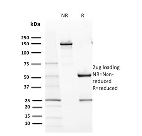 SDS-PAGE analysis of purified, BSA-free CD117 antibody (clone KIT/2670) as confirmation of integrity and purity.