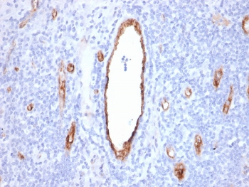 vWF Antibody / Vascular Permeability Marker Antibody. Immunohistochemistry analysis of human tonsil tissue shows HRP-DAB brown staining of endothelial cells outlining vascular channels within lymphoid tissue. The staining highlights continuous vessel linings with localized variation in signal intensity along the endothelial surface, consistent with differences in endothelial activation state and barrier function. Vessel-associated signal is clearly distinguished from surrounding lymphoid cells, enabling visualization of vascular compartments and assessment of endothelial integrity within the tissue. Clone VWF/2480 enables evaluation of vascular structure together with permeability-associated endothelial response. HIER: boil tissue sections in pH 9 10mM Tris with 1mM EDTA for 20 min and allow to cool before testing.