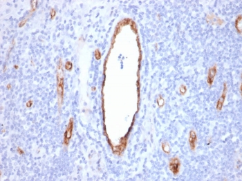 vWF Antibody / Vascular Remodeling Marker Antibody. Immunohistochemistry analysis of human tonsil tissue shows HRP-DAB brown staining of endothelial cells outlining vascular channels with variable diameter and morphology within lymphoid tissue. The staining highlights both larger, well-formed vessels and smaller branching structures, reflecting heterogeneity in vessel size and organization. Endothelial-lined channels display differences in shape and thickness, consistent with structural variation associated with vascular remodeling. Clone rVWF/2480 enables visualization of vessel architecture and morphological variation across the tissue. HIER: boil tissue sections in pH 9 10mM Tris with 1mM EDTA for 20 min and allow to cool before testing.