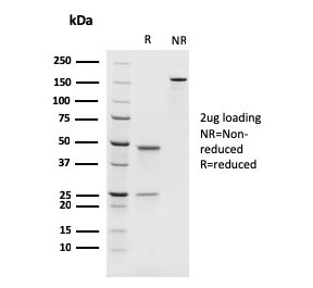 SDS-PAGE analysis of purified, BSA-free PAX8 Antibody / Mullerian Epithelial Marker Antibody (clone rPAX8/1492) as confirmation of integrity and purity.
